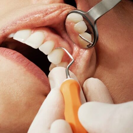 Dentist checking gum line